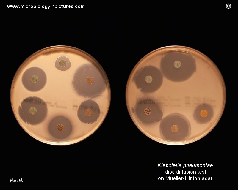 Klebsiella pneumoniae disc diffusion test